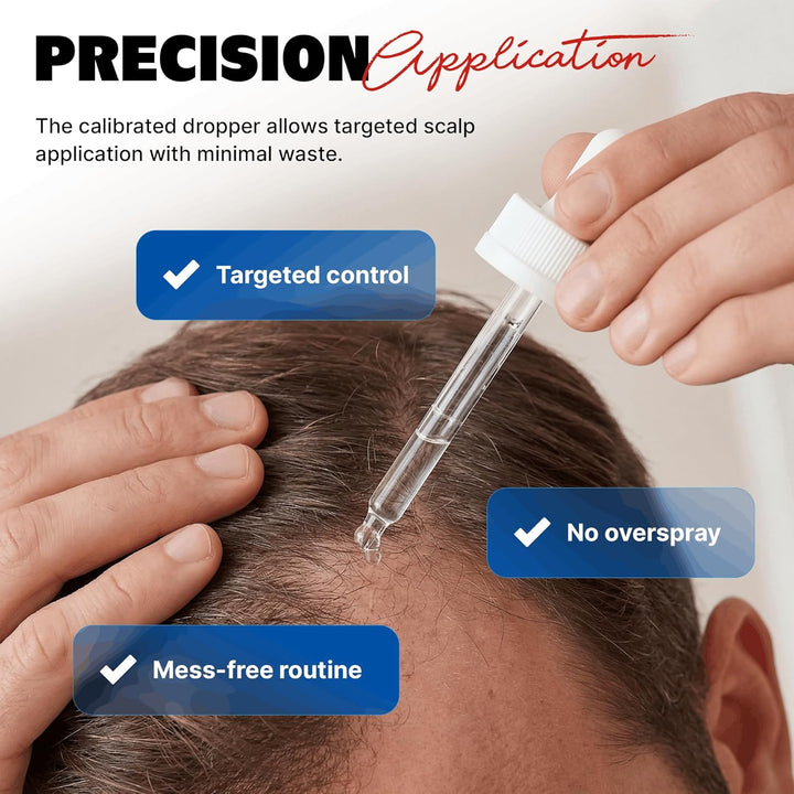 Kirkland Minoxidil 5% Extra Strength – 6 Month Hair Regrowth Supply for Men